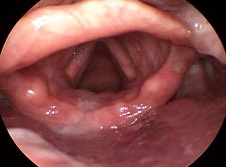 com.bmj.content.model.assessment.Caption@233f4cd1