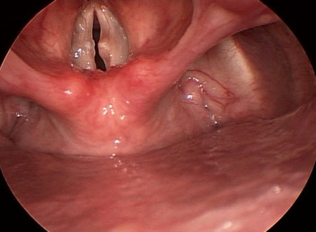 com.bmj.content.model.assessment.Caption@1a2827a0