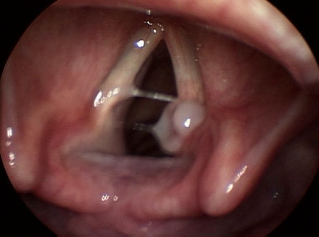 com.bmj.content.model.assessment.Caption@16403b01