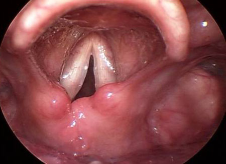 com.bmj.content.model.assessment.Caption@6018ff24