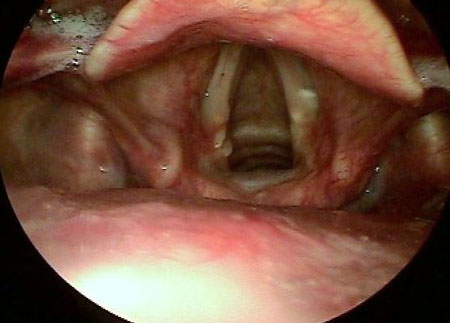 com.bmj.content.model.assessment.Caption@6e34cf81
