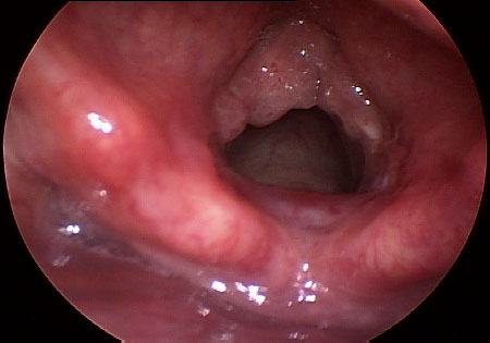 com.bmj.content.model.assessment.Caption@75d1286c