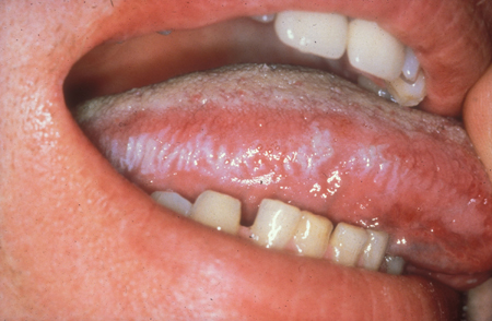 com.bmj.content.model.assessment.Caption@22458bd2