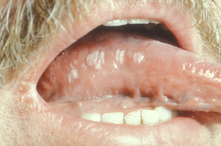 com.bmj.content.model.assessment.Caption@49d7bbfc