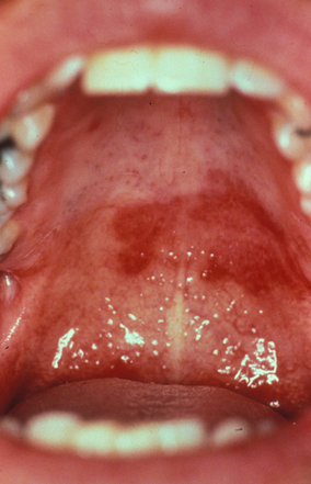 com.bmj.content.model.assessment.Caption@65245f70