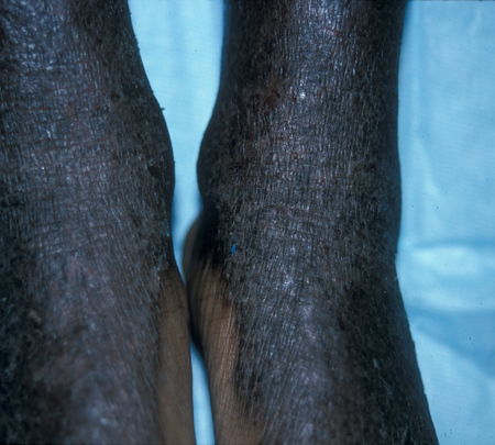 com.bmj.content.model.assessment.Caption@5fd52140