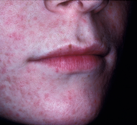 com.bmj.content.model.assessment.Caption@367a0095