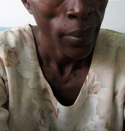 com.bmj.content.model.assessment.Caption@5da02a8c