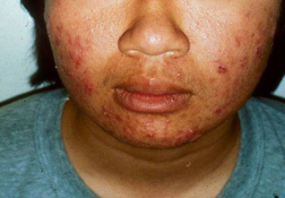 com.bmj.content.model.assessment.Caption@2fb6dfab