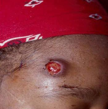 com.bmj.content.model.assessment.Caption@2a02e2ff