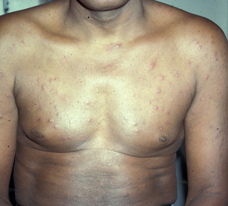 com.bmj.content.model.assessment.Caption@3175e711
