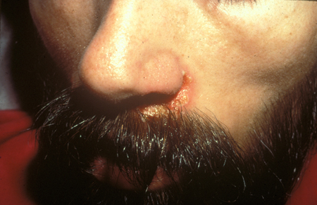 com.bmj.content.model.assessment.Caption@488d97e