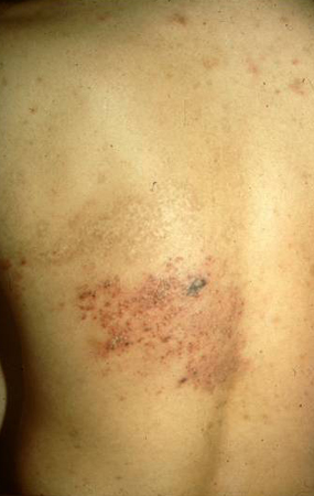 com.bmj.content.model.assessment.Caption@3f3f367c