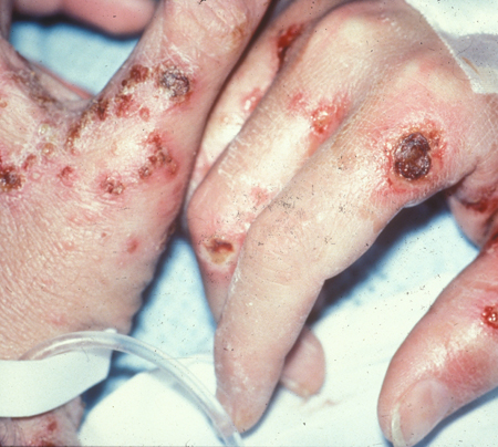 com.bmj.content.model.assessment.Caption@f73fc8d