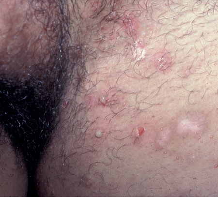 com.bmj.content.model.assessment.Caption@76c7e94c