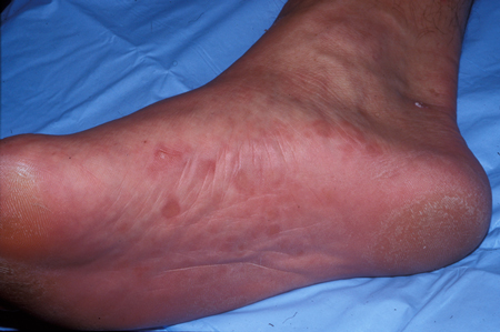 com.bmj.content.model.assessment.Caption@5c7c79f7