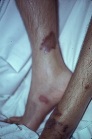 com.bmj.content.model.assessment.Caption@9ee1937