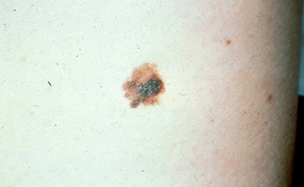 com.bmj.content.model.assessment.Caption@54331359