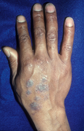 com.bmj.content.model.assessment.Caption@2556684c