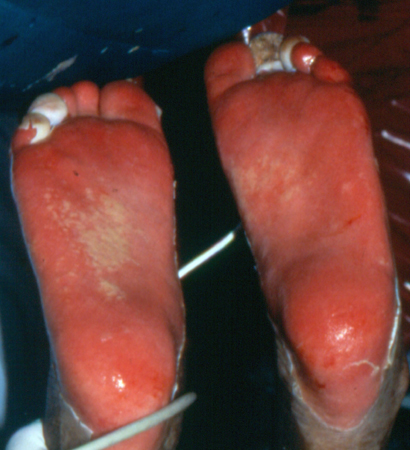 com.bmj.content.model.assessment.Caption@12f7b176