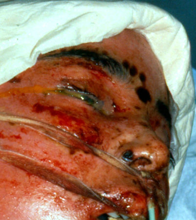 com.bmj.content.model.assessment.Caption@56f5ed47