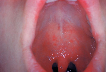 com.bmj.content.model.assessment.Caption@5caabf50
