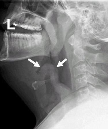 Assessment of dyspnoea images