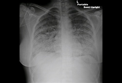 com.bmj.content.model.assessment.Caption@50559cb8