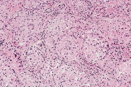 com.bmj.content.model.assessment.Caption@2857bfea