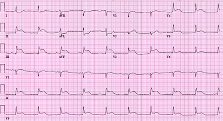 com.bmj.content.model.assessment.Caption@4fcc6f09