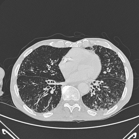 com.bmj.content.model.assessment.Caption@7923c9b8