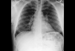 com.bmj.content.model.assessment.Caption@52004645