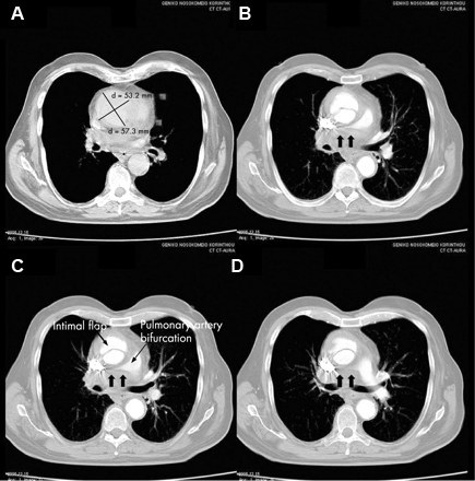com.bmj.content.model.assessment.Caption@140bf420