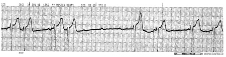 com.bmj.content.model.assessment.Caption@684aa2bb