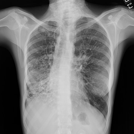 com.bmj.content.model.assessment.Caption@4d65de0