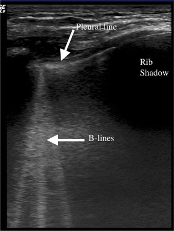 com.bmj.content.model.assessment.Caption@381b586e