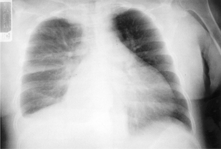 com.bmj.content.model.assessment.Caption@71f51321
