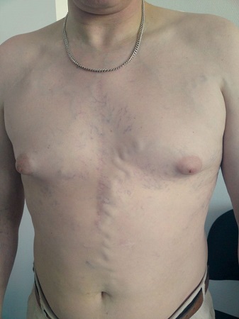 com.bmj.content.model.assessment.Caption@1b0f3acc