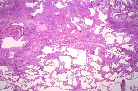 com.bmj.content.model.assessment.Caption@1261c27