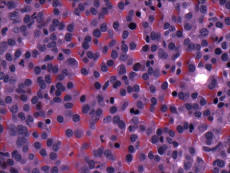 com.bmj.content.model.assessment.Caption@6781d4fc