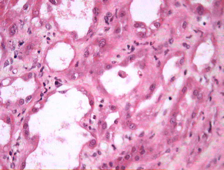 com.bmj.content.model.assessment.Caption@137076ae