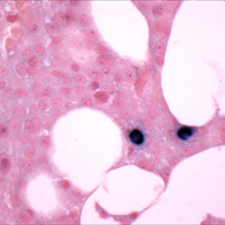 com.bmj.content.model.assessment.Caption@3dc0383a