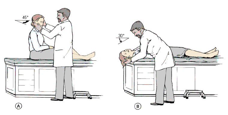 Evaluation of falls in the elderly images