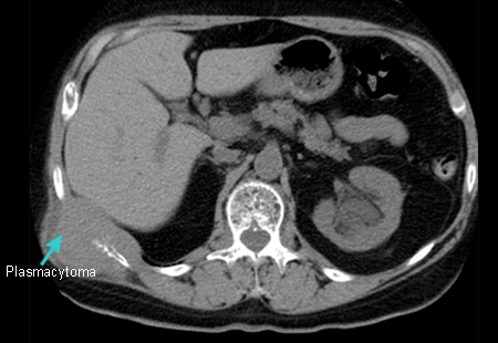 com.bmj.content.model.assessment.Caption@f97a44c