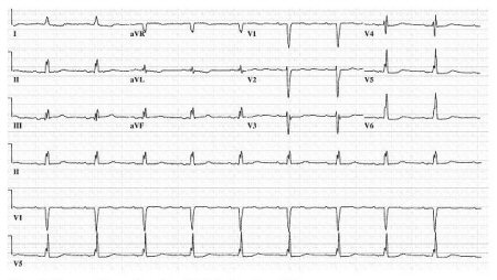 com.bmj.content.model.assessment.Caption@1150fcf3