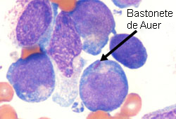 com.bmj.content.model.assessment.Caption@60fdd400