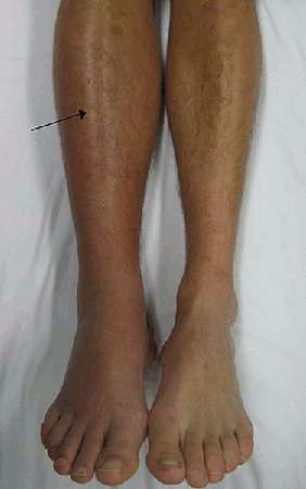 com.bmj.content.model.assessment.Caption@30f89e83
