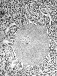 Rabies images