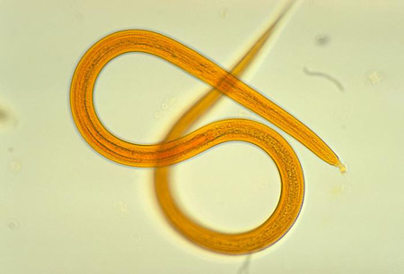 Strongyloides infection images