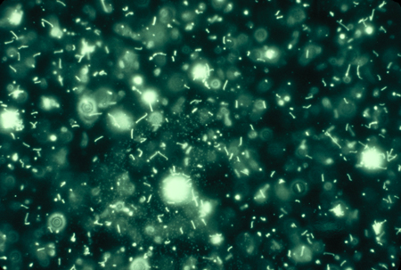 Leptospirosis images
